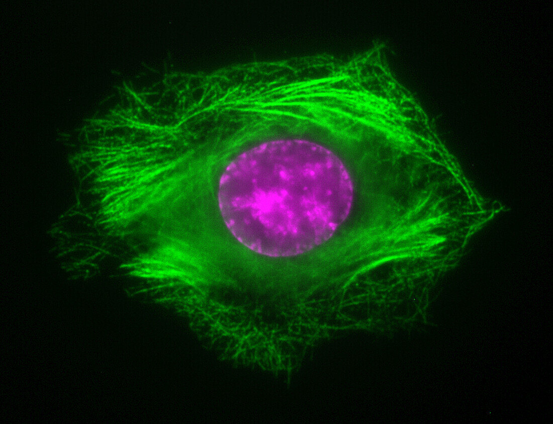 Interphase cell treated with Taxol, light micrograph