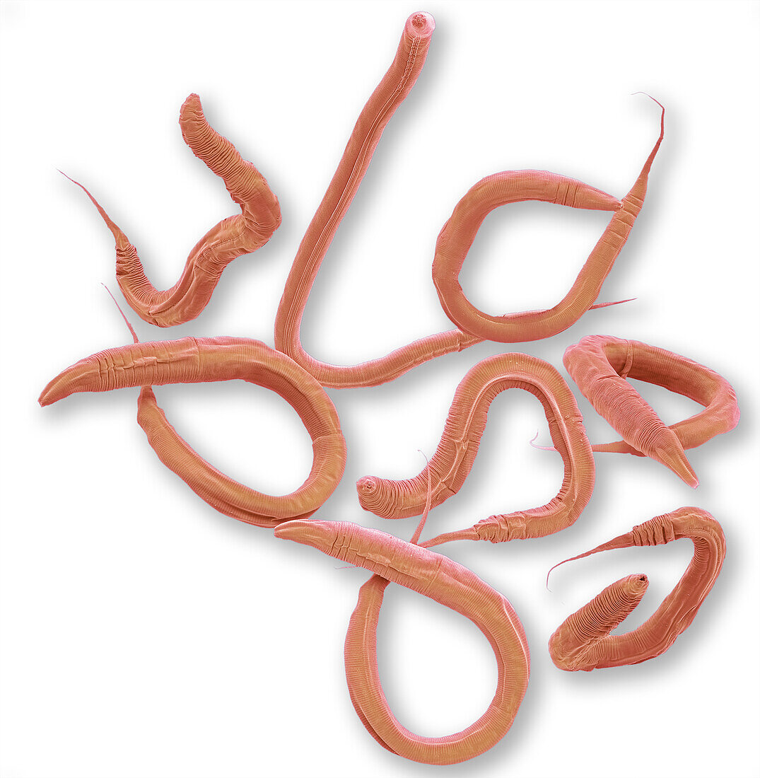 Caenorhabditis elegans worms, SEM