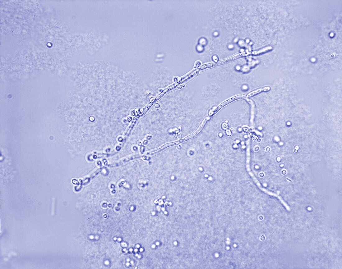 Candidiasis albicans fungus, light micrograph