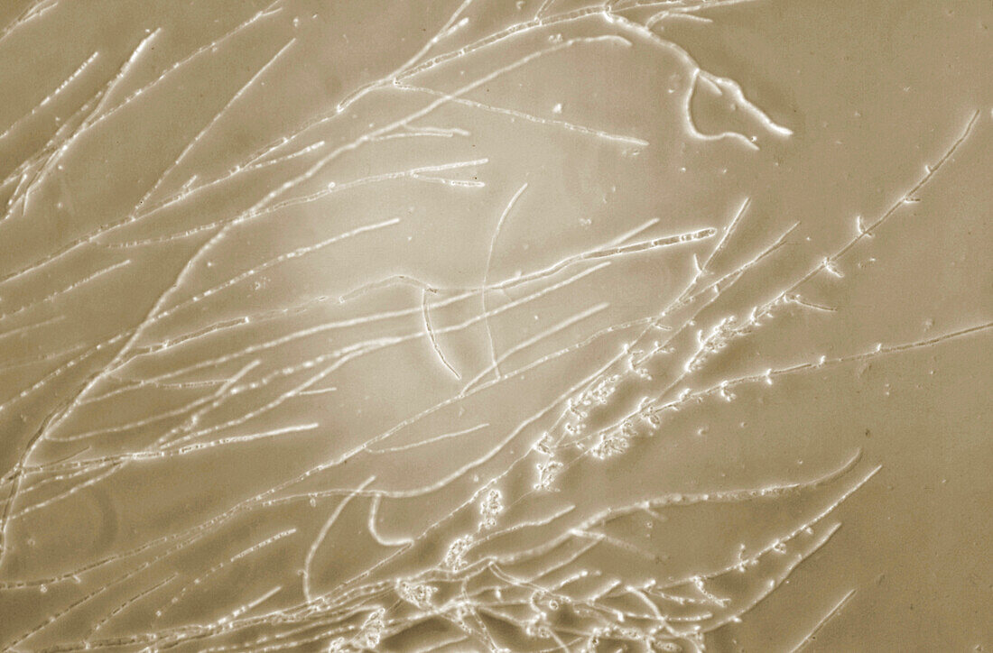 Candida albicans fungus, light micrograph