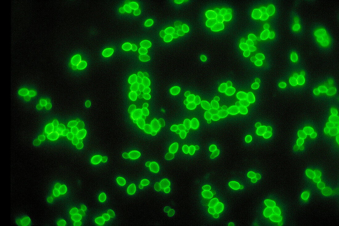 Candida albicans yeast cells, light micrograph