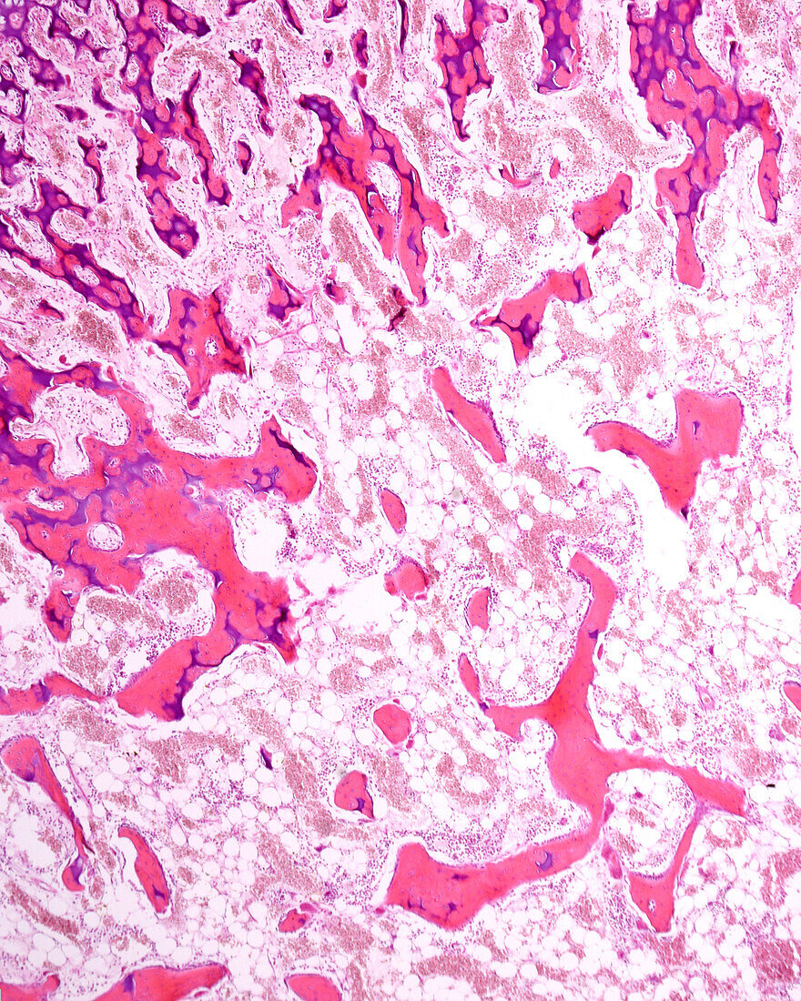 Endochondral ossification, light micrograph