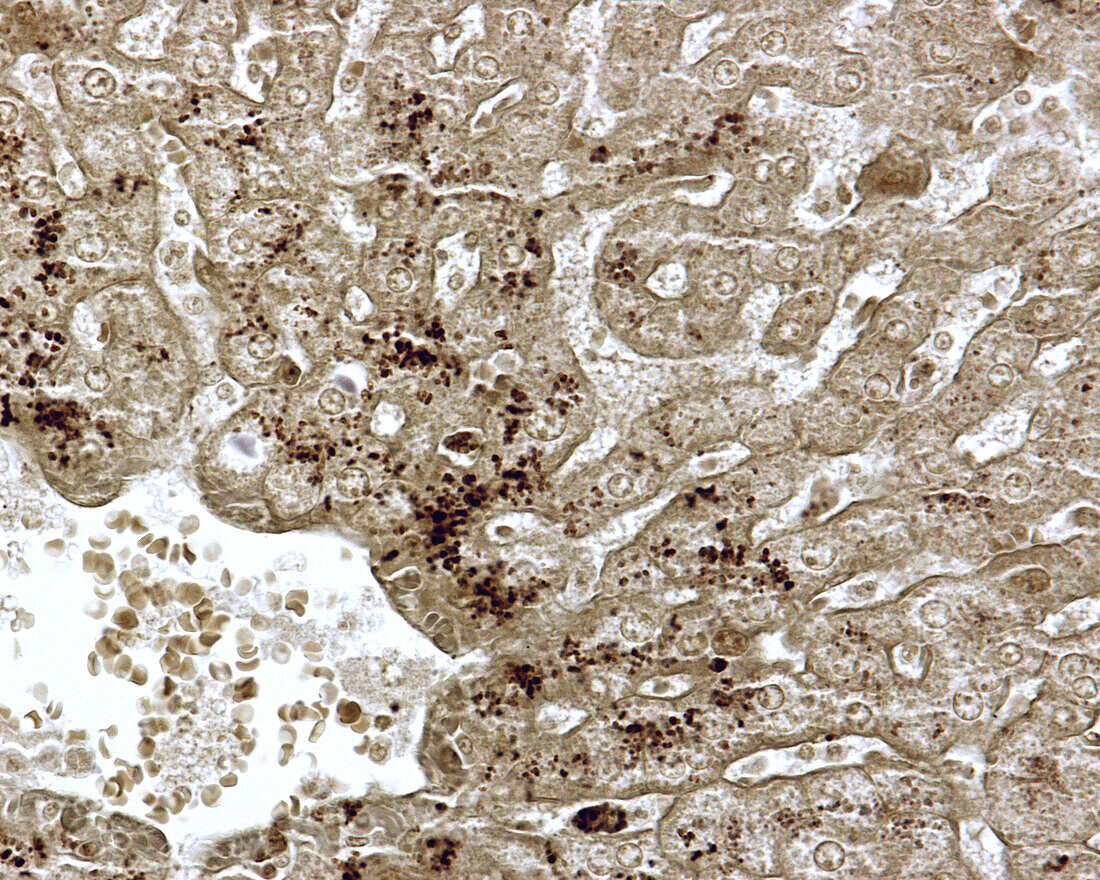 Lipid droplets in liver cells, light micrograph