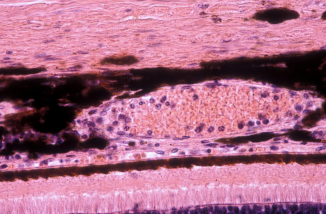 Choroid and retina, light micrograph