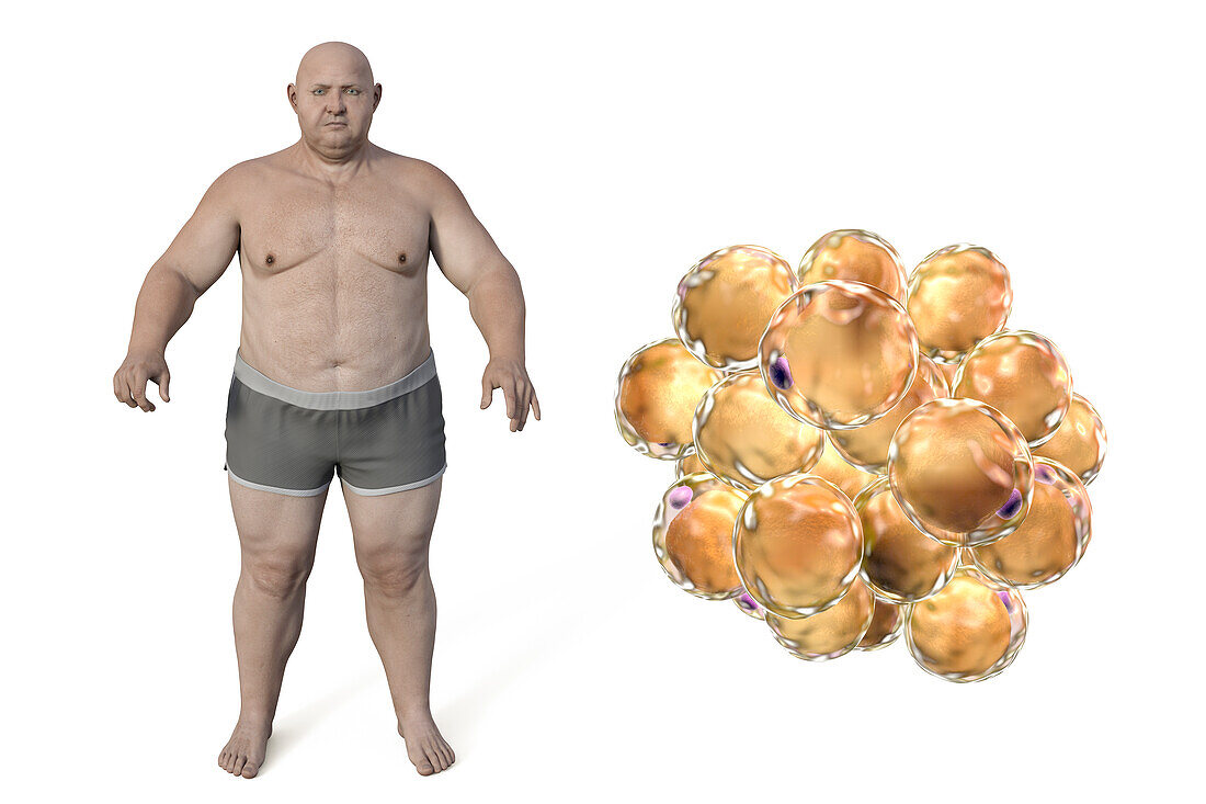 Obese man and fat cells, illustration