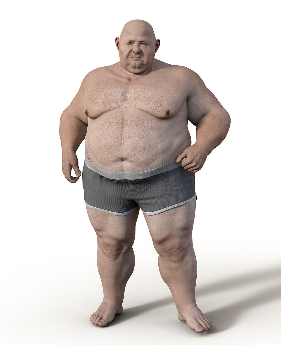 Obese man standing, illustration