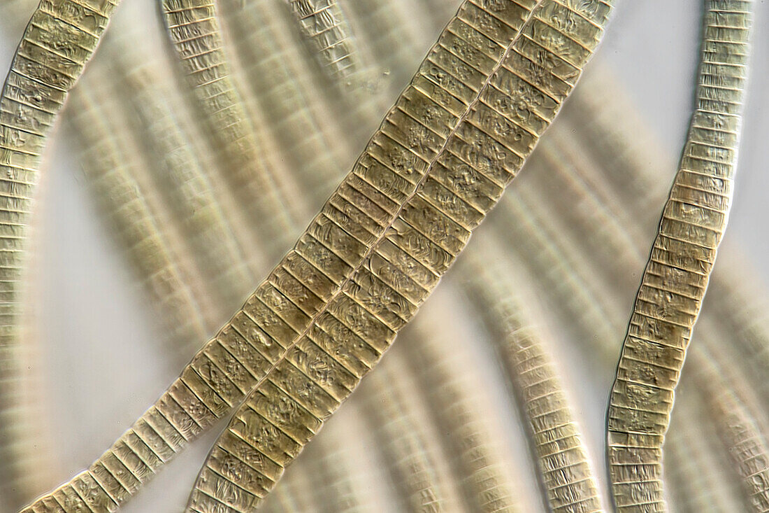 Phormidium sp. algae, light micrograph
