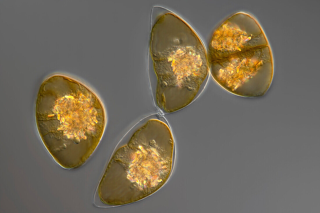 Pyrocystis sp. algae, light micrograph