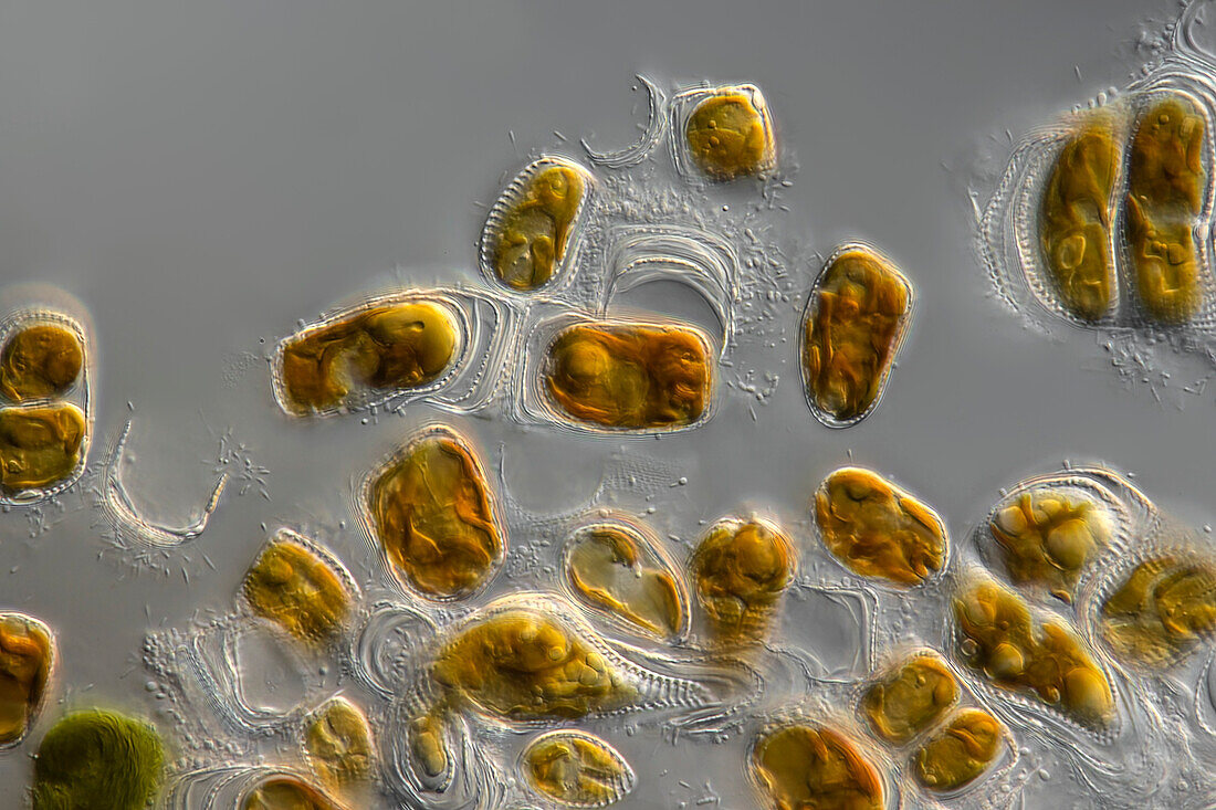 Achnanthes sp. algae, light micrograph