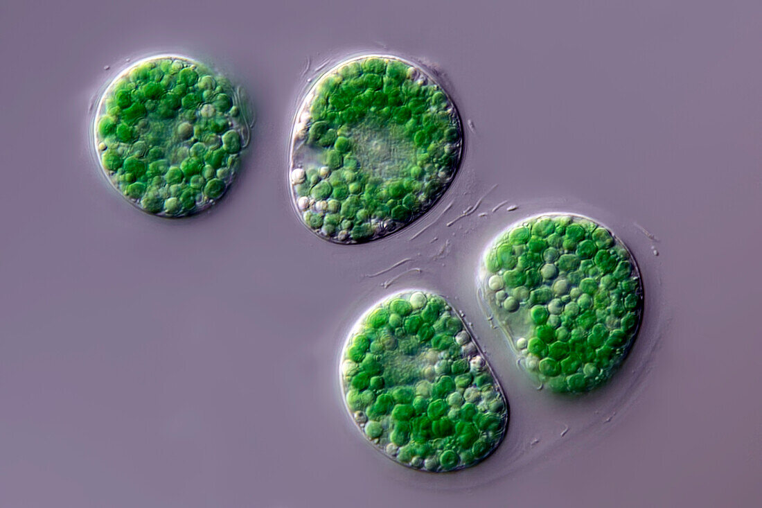 Cyanoptyche algae, light micrograph