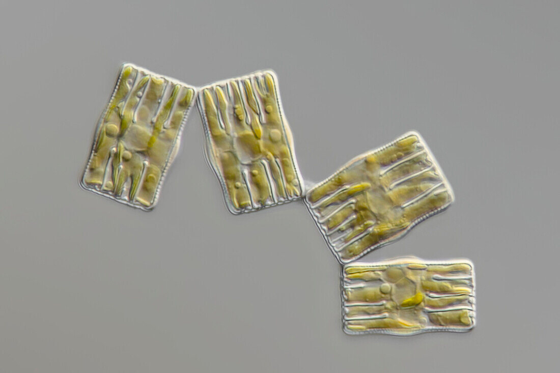 Tabellaria sp. algae, light micrograph