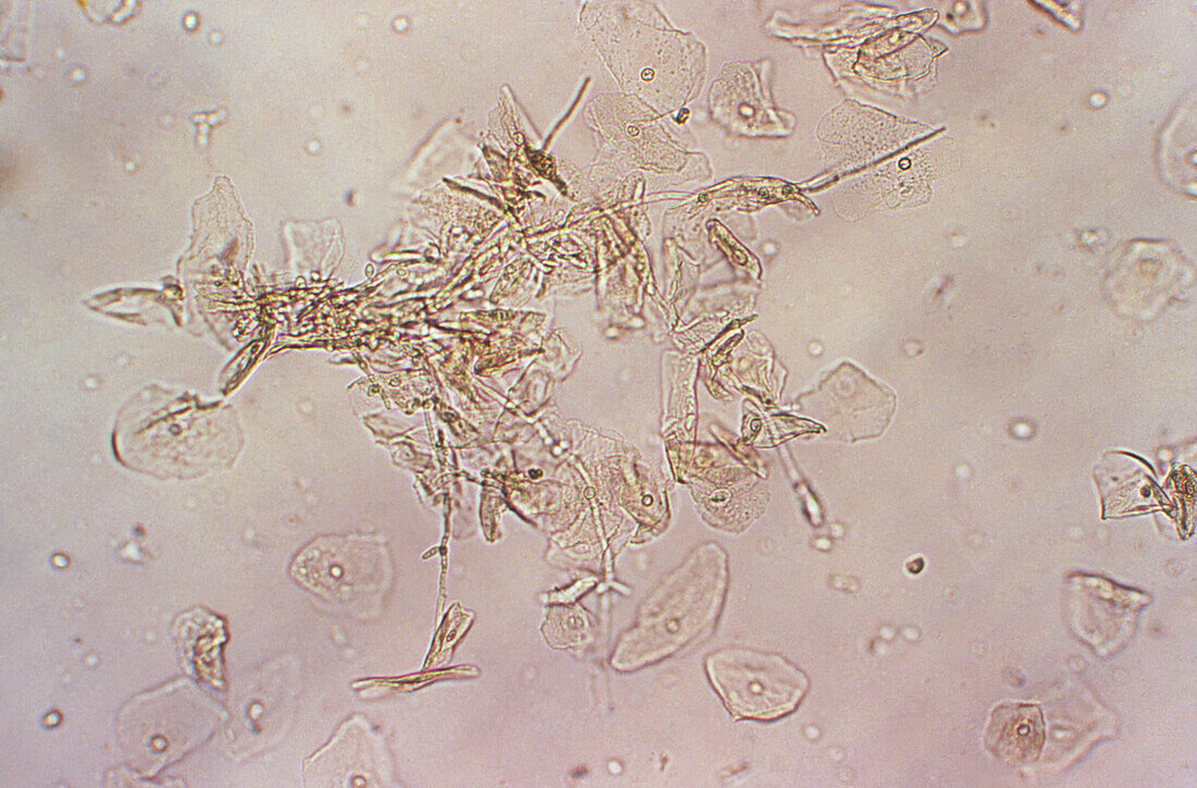 Candida albicans, light micrograph