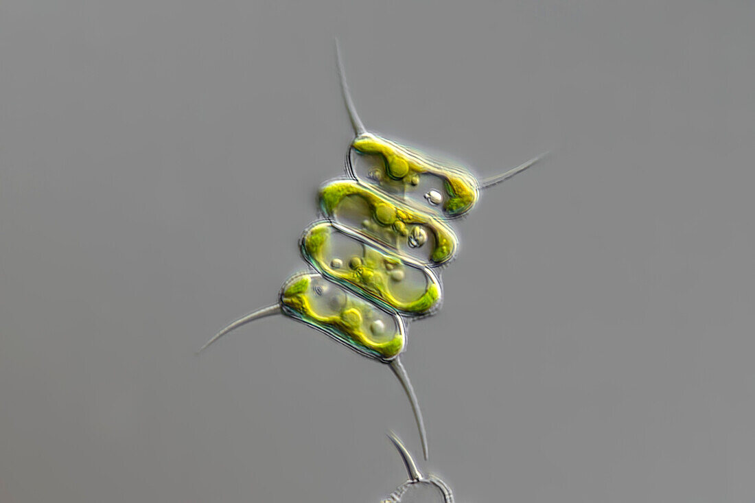 Scenedesmus quadricauda algae, light micrograph