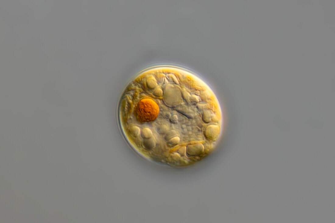 Leonella granifera alga, light micrograph