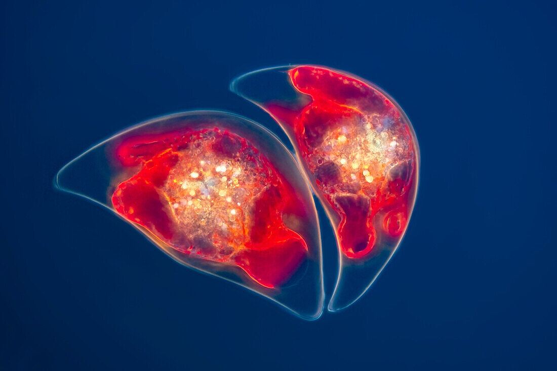Pyrocystis lunula algae, light micrograph