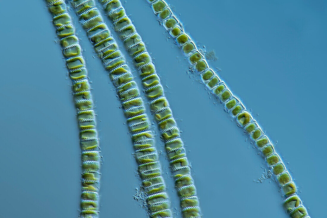 Staurosira algae, light micrograph