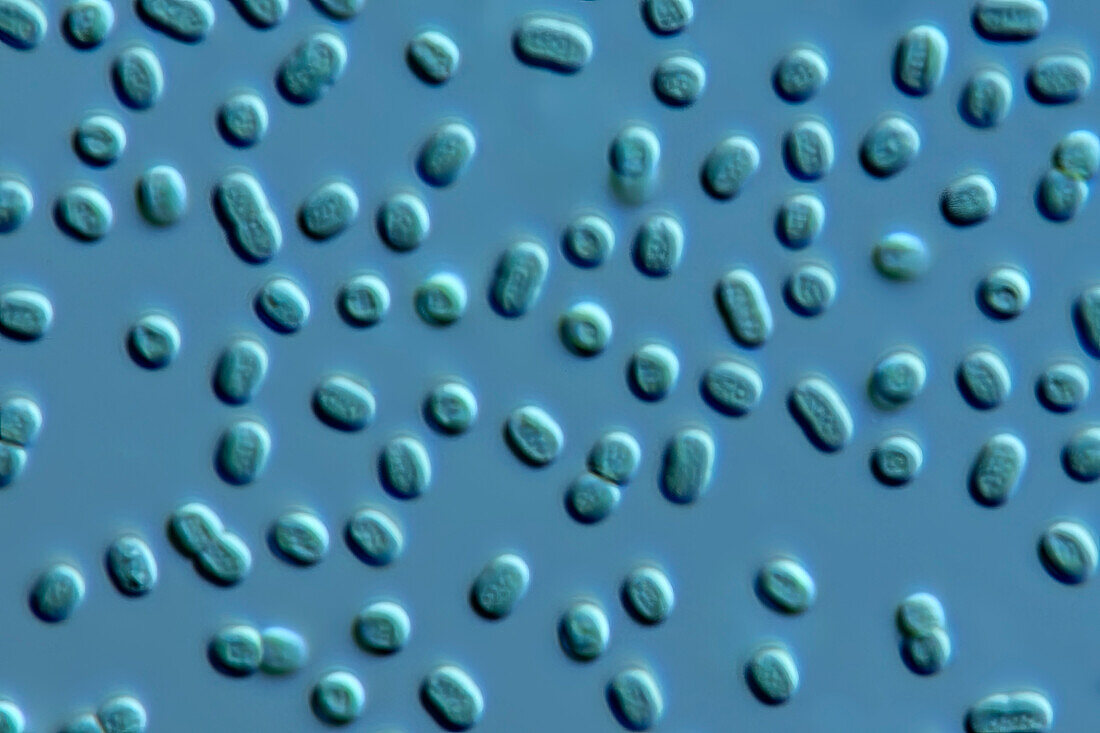 Synechococcus algae, light micrograph