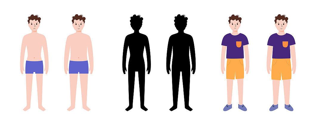 Underweight and normal weight boy, illustration