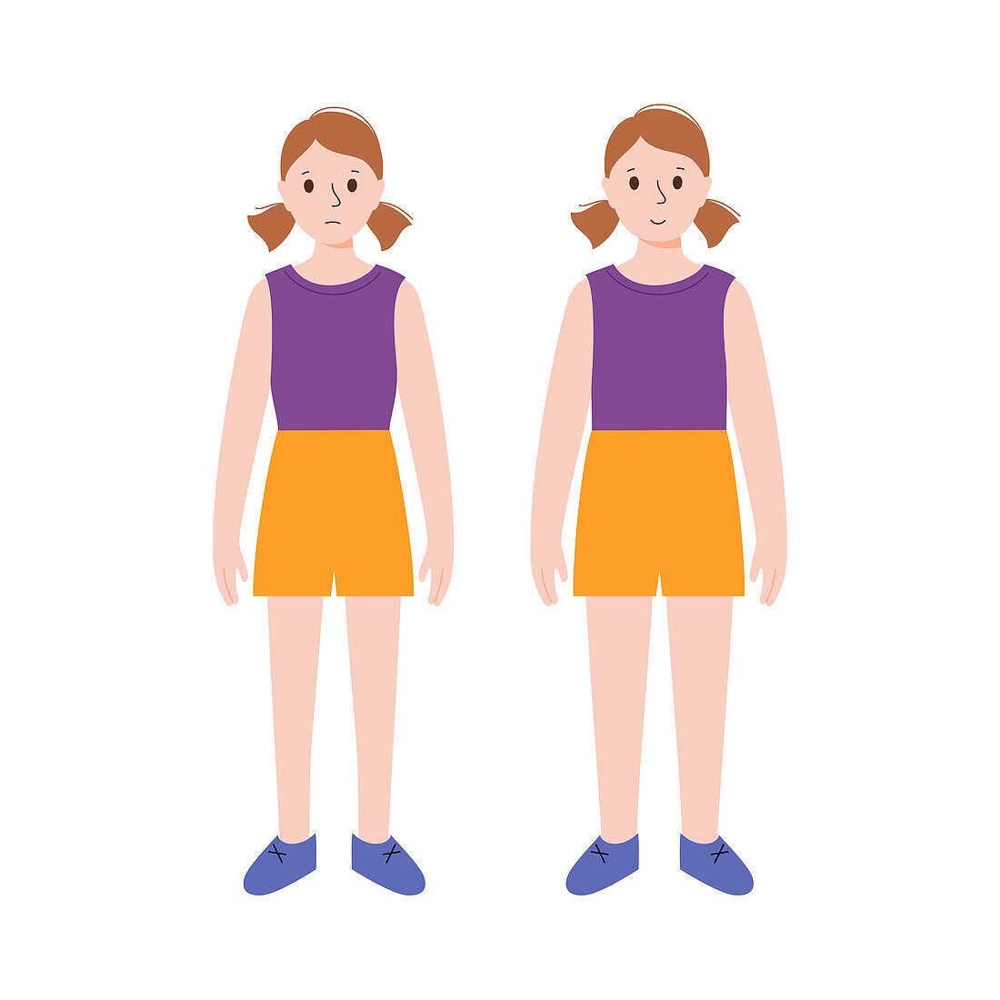 Underweight and normal weight girl, illustration
