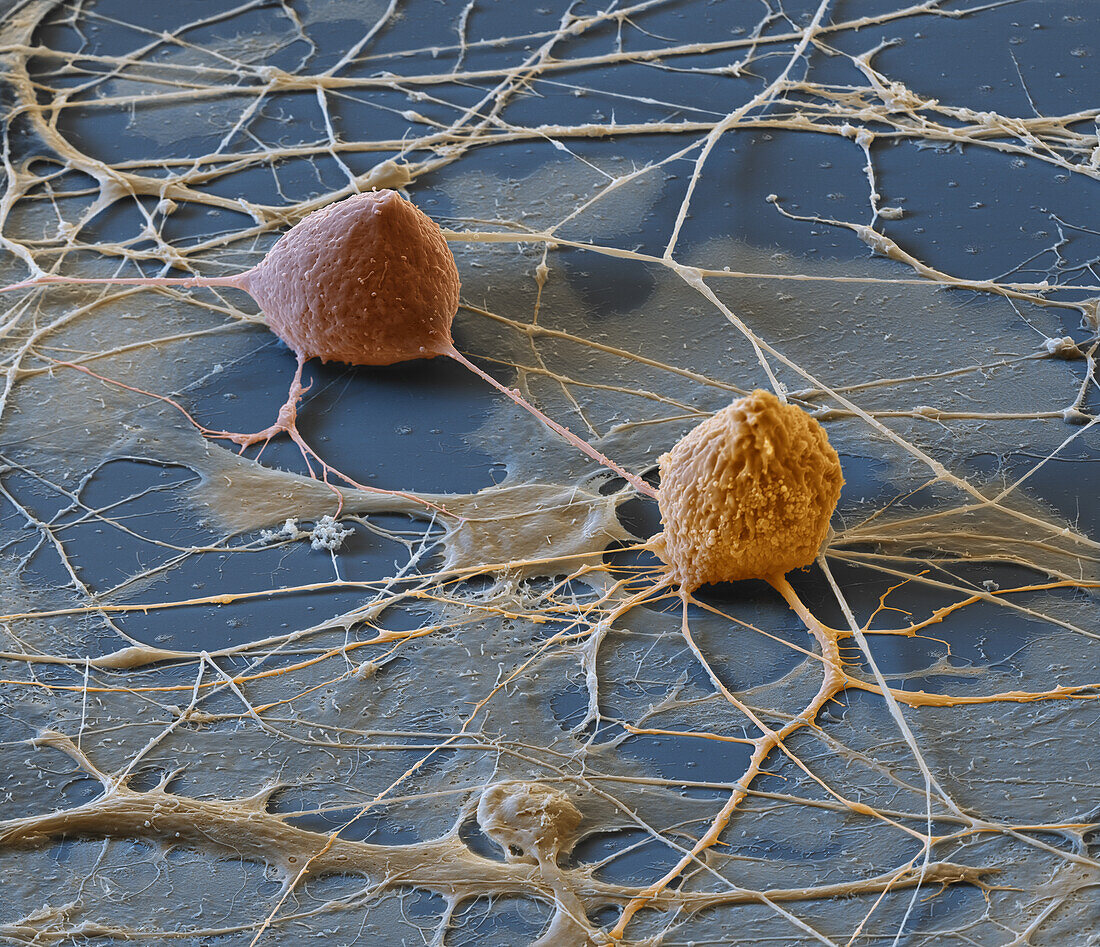 Spinal ganglion nerve cells, SEM