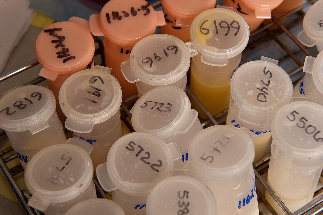 Test tubes in the diagnostic lab