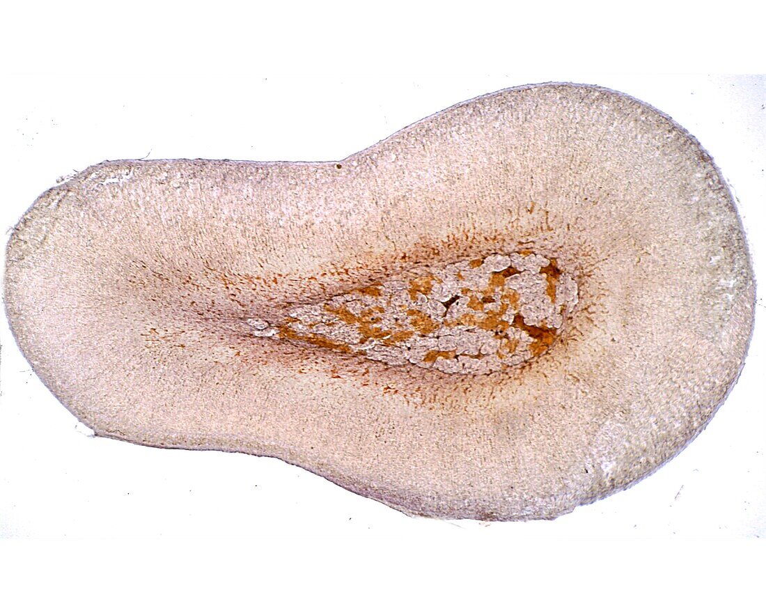 Adrenal medulla, light micrograph