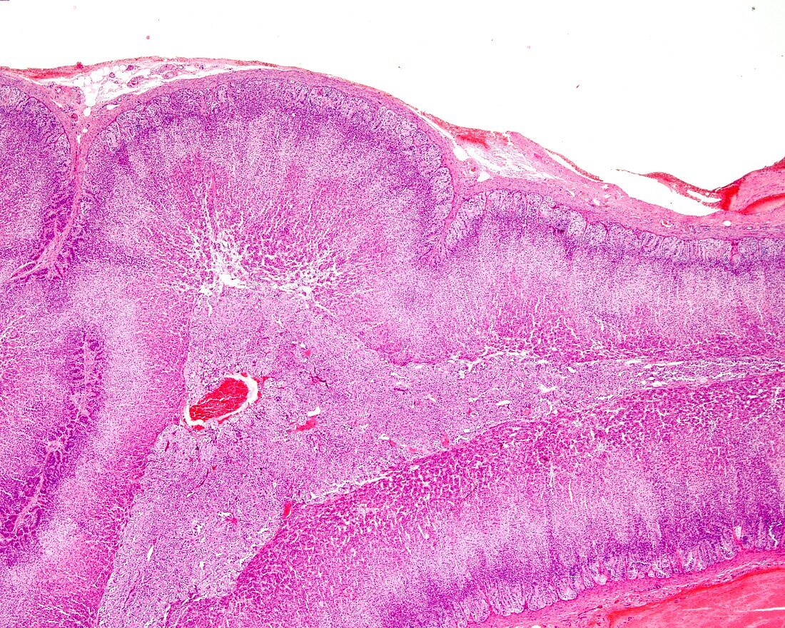 Human adrenal gland cortex and medulla, light micrograph