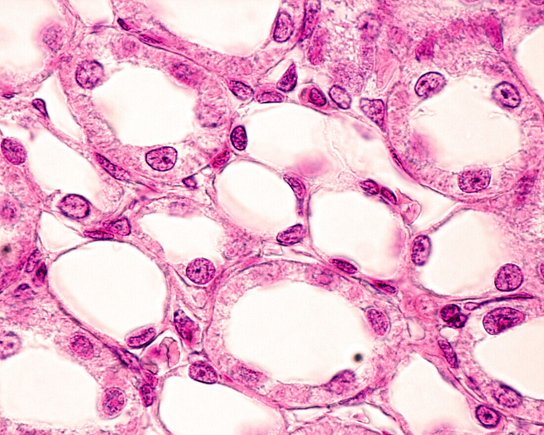 Kidney tubules and loops of Henle, light micrograph