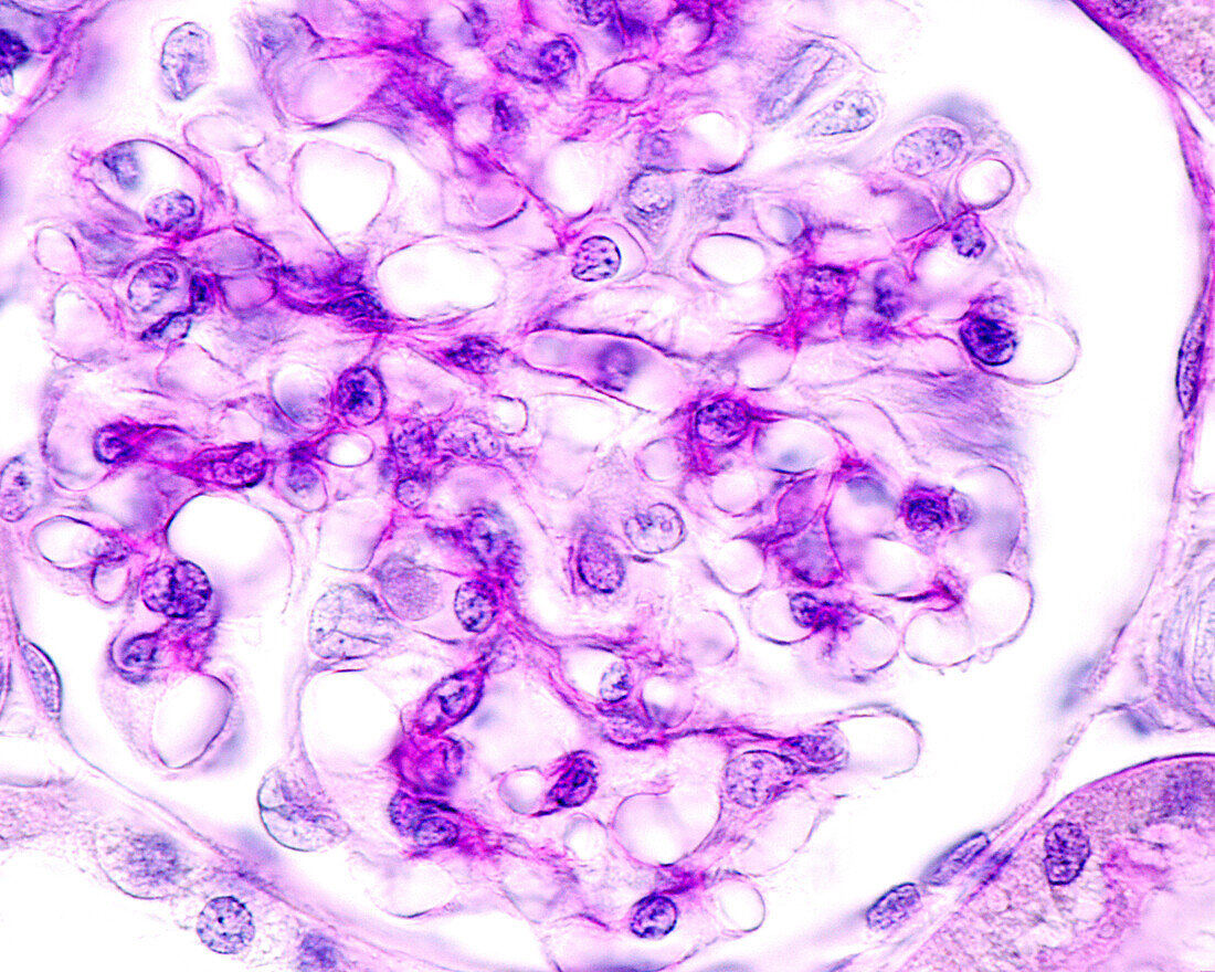 Kidney glomerulus, light micrograph
