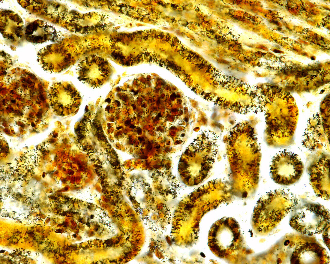 Kidney stained with Polakâ??s silver method, light micrograph