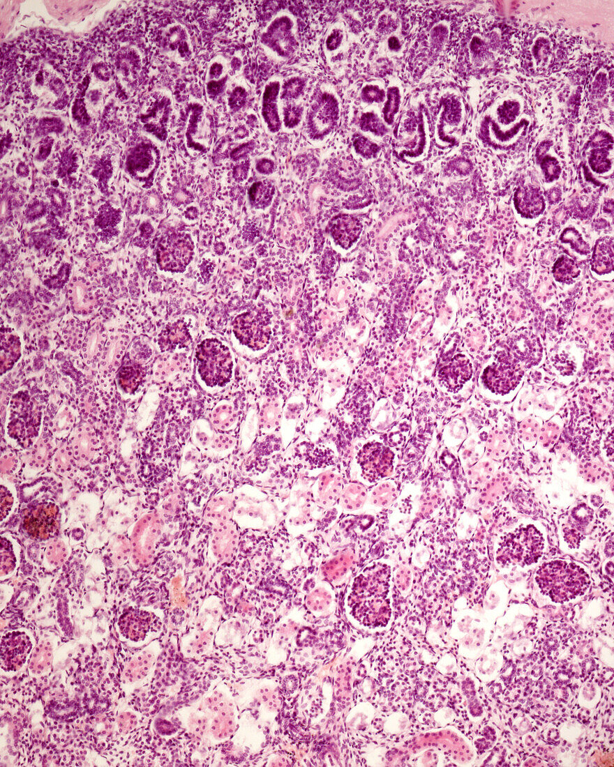 Human foetal kidney corpuscle development, light micrograph