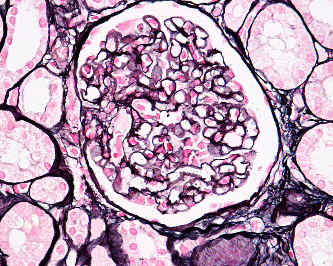 Kidney glomerulus basement membranes, light micrograph