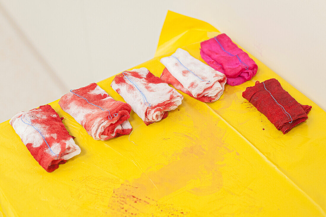 Blood-stained dressings used in surgery