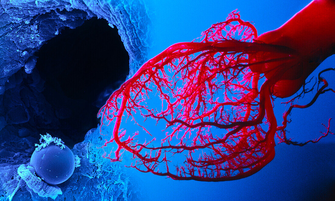 Coronary blood vessels, composite image