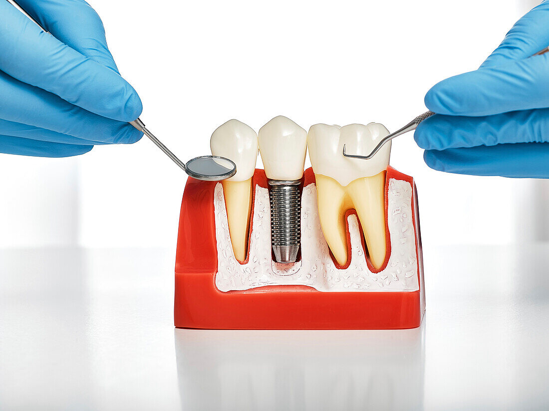 Dental treatment, conceptual image