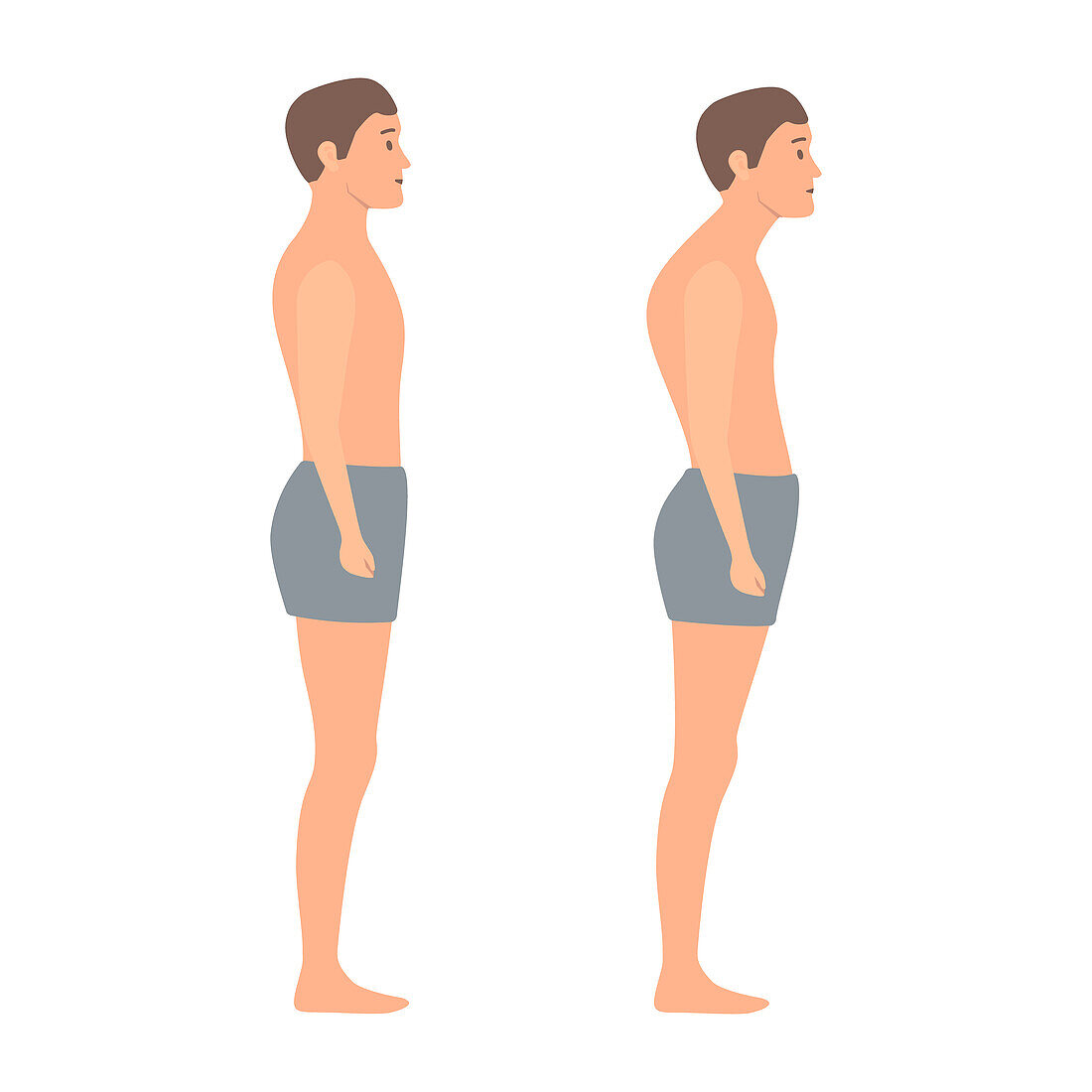 Good and bad posture, conceptual illustration
