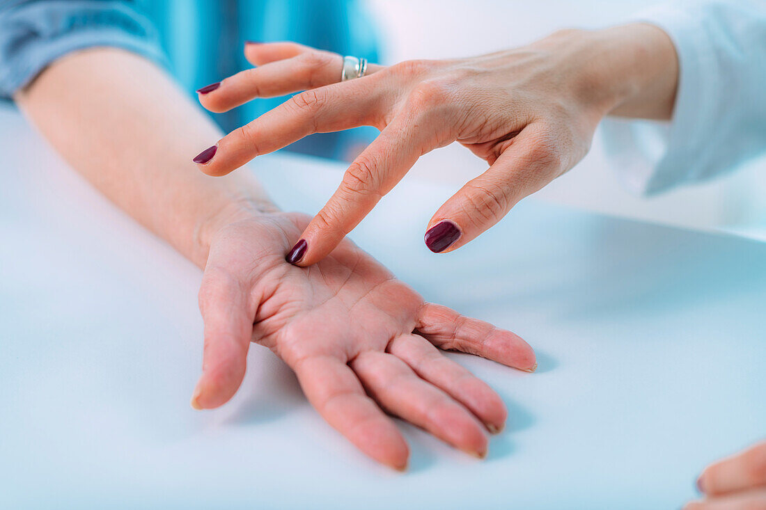 Examining the hand of a patient with carpal tunnel syndrome