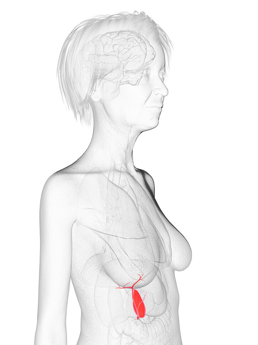 Elderly woman's gallbladder, illustration