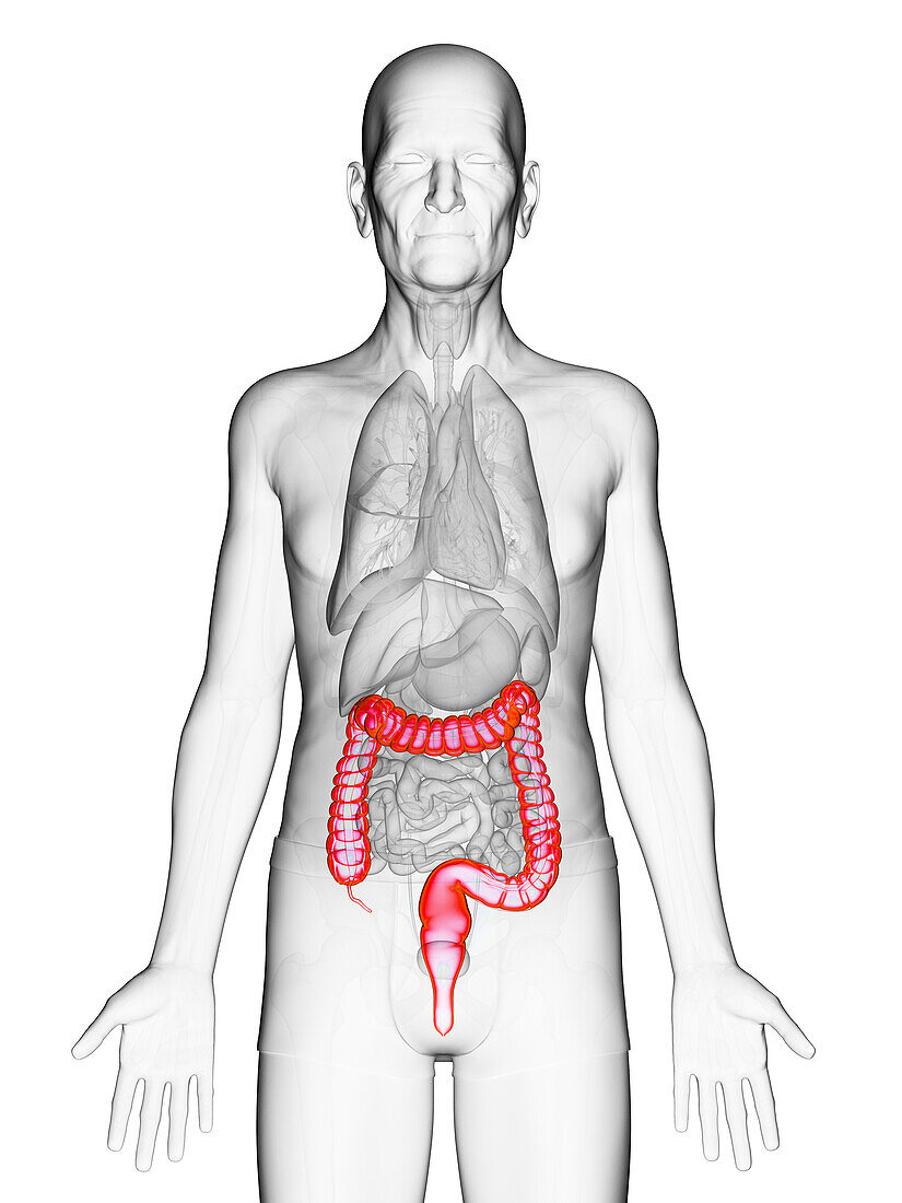 Elderly man's colon, illustration