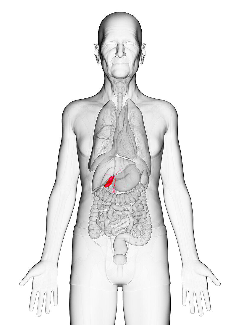 Elderly man's gallbladder, illustration