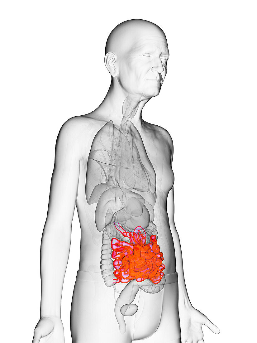 Elderly man's small intestine, illustration