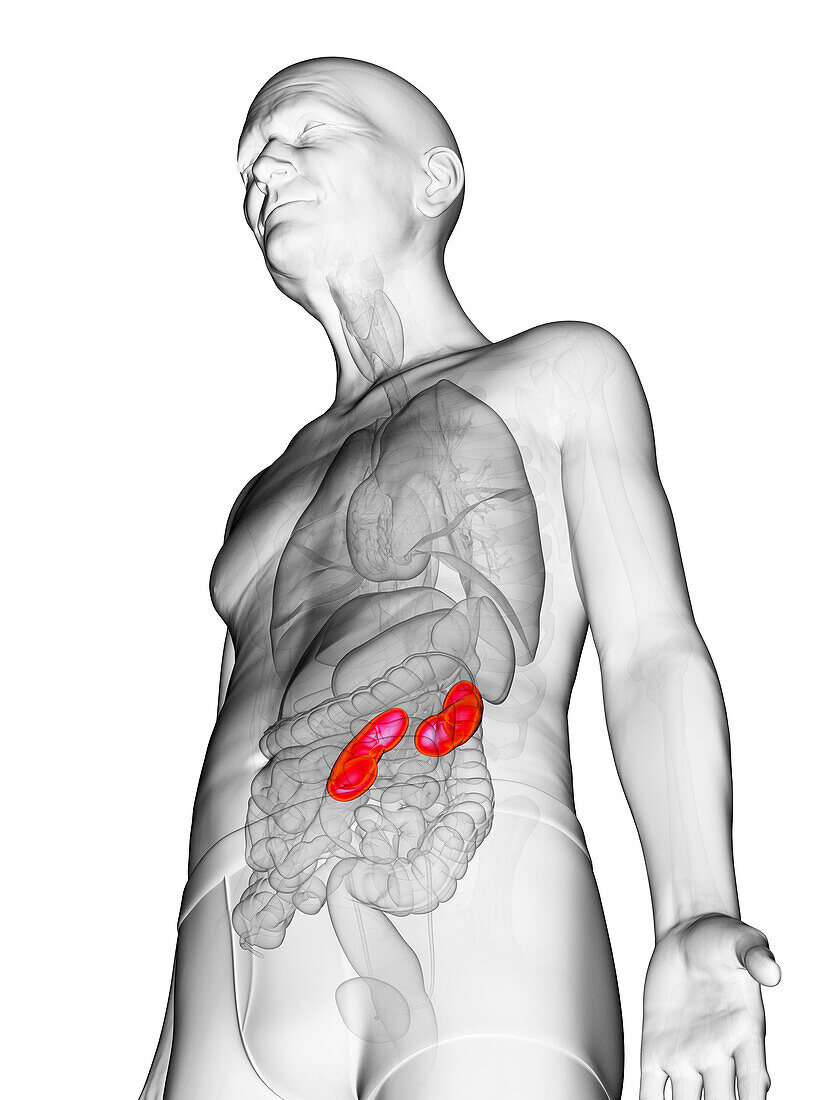 Elderly man's kidneys, illustration