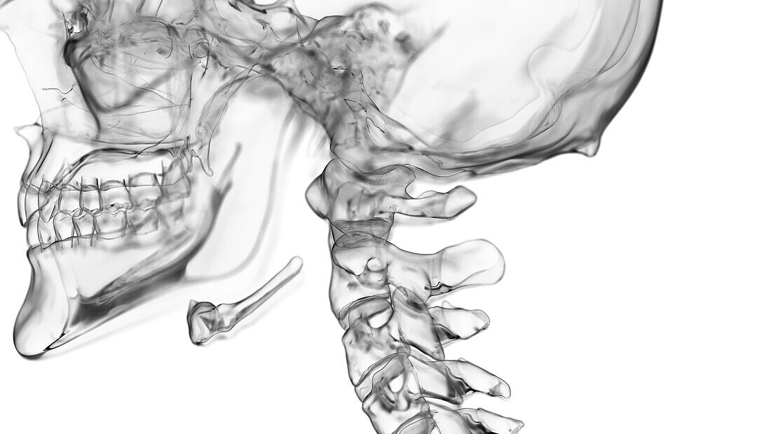 Atlas vertebrae, illustration