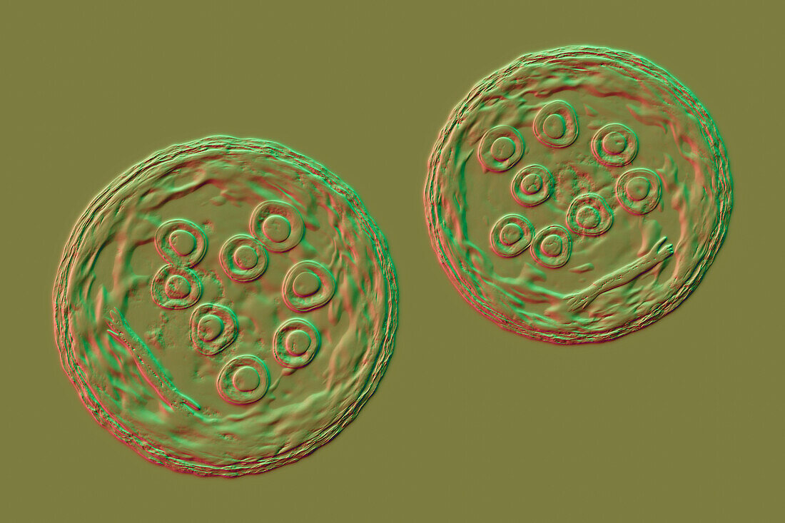 Cysts of Entamoeba coli protozoan, illustration