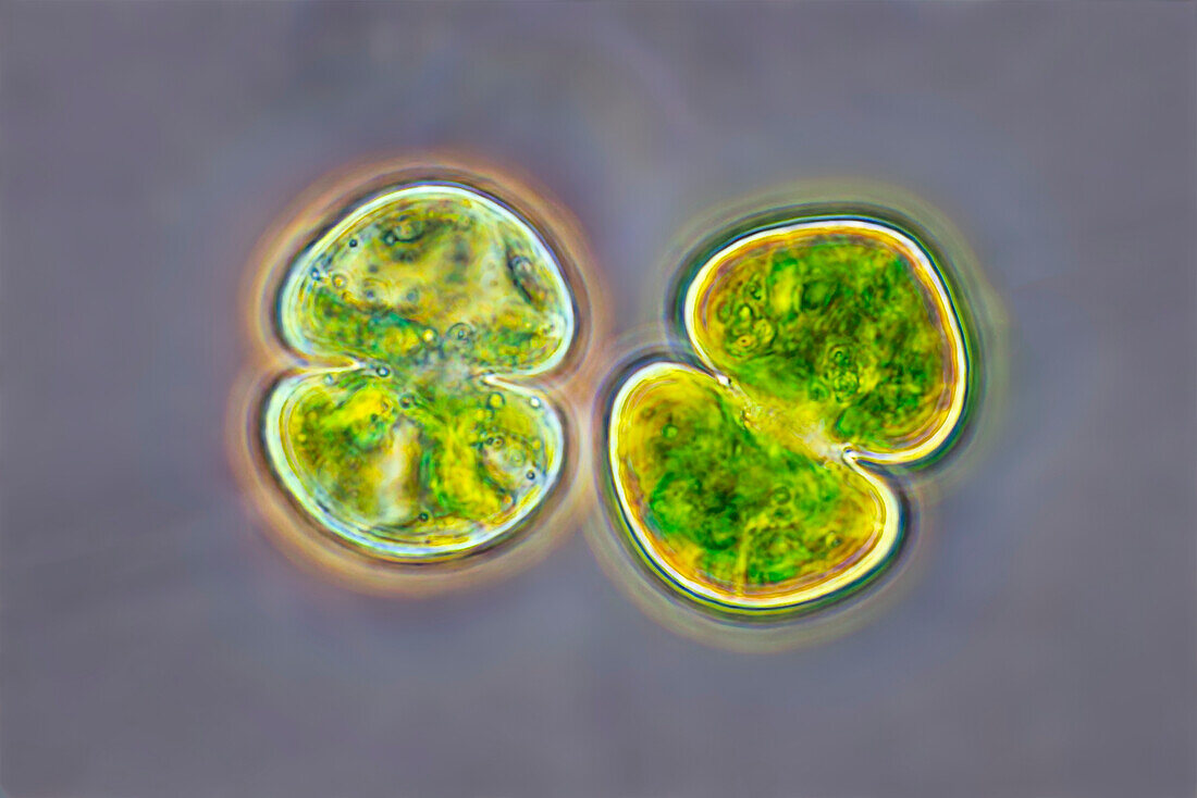 Cosmarium subtumidum cf., algae, light micrograph