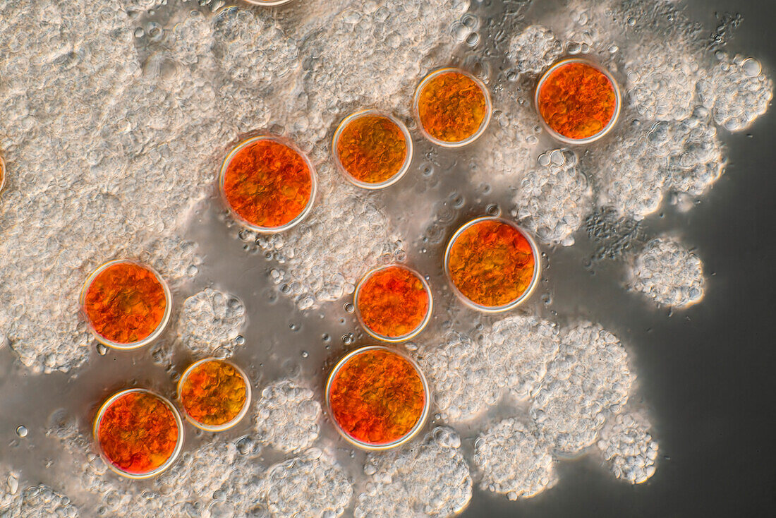 Haematococcus sp. algae, light micrograph