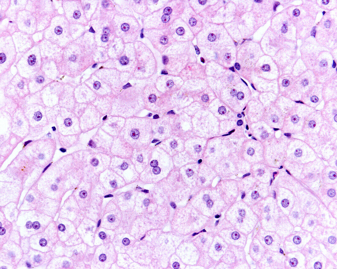 Liver cells, light micrograph