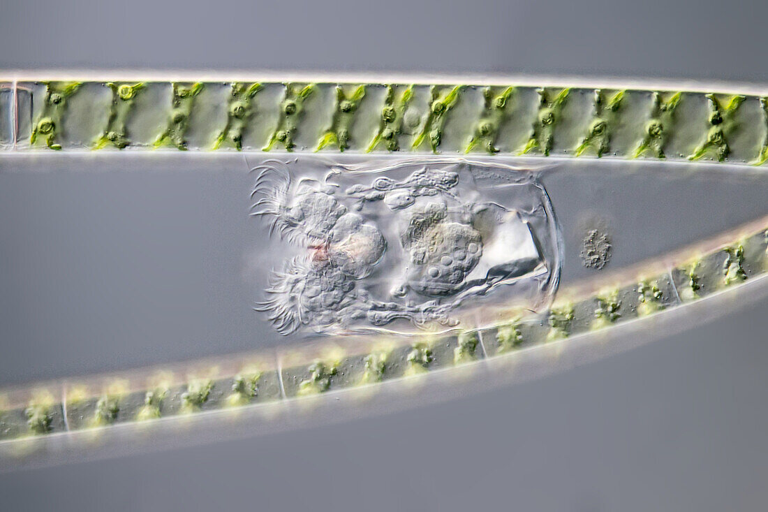 Keratella rotifer and Spirogyra algae, light micrograph
