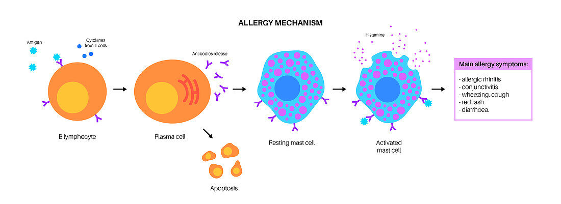 Allergy mechanism, illustration