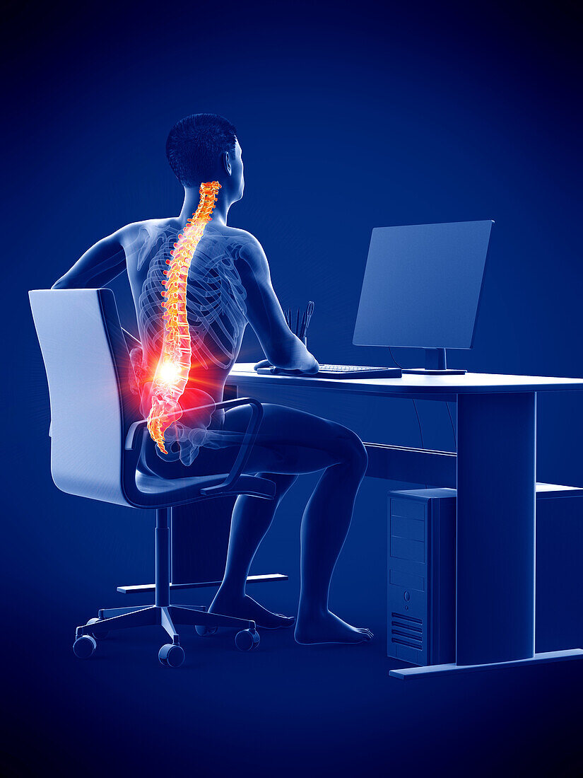 Office worker's painful back, illustration
